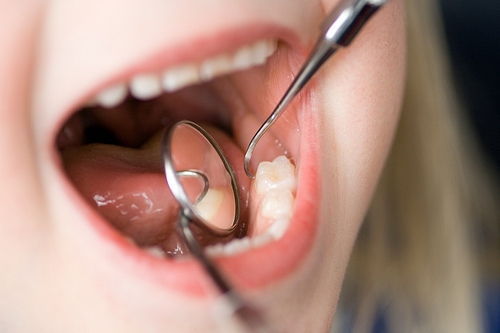 A child's mouth with a stethoscope in it.
