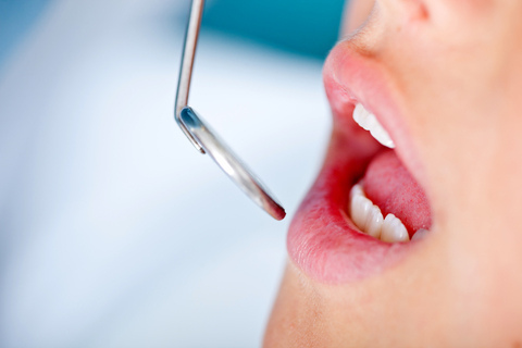pedo-pediatricdentistry A close up of a woman's mouth with a toothpick in it.